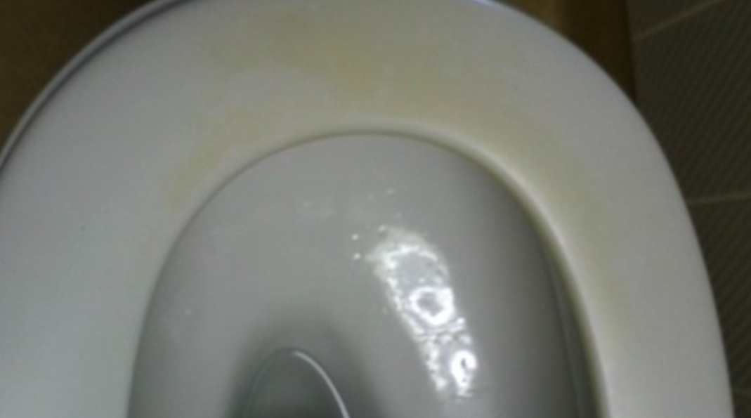How to Remove Urine Stains From a Toilet Seat The Indoor Haven