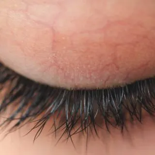 How to Repair Eyelashes After Extensions